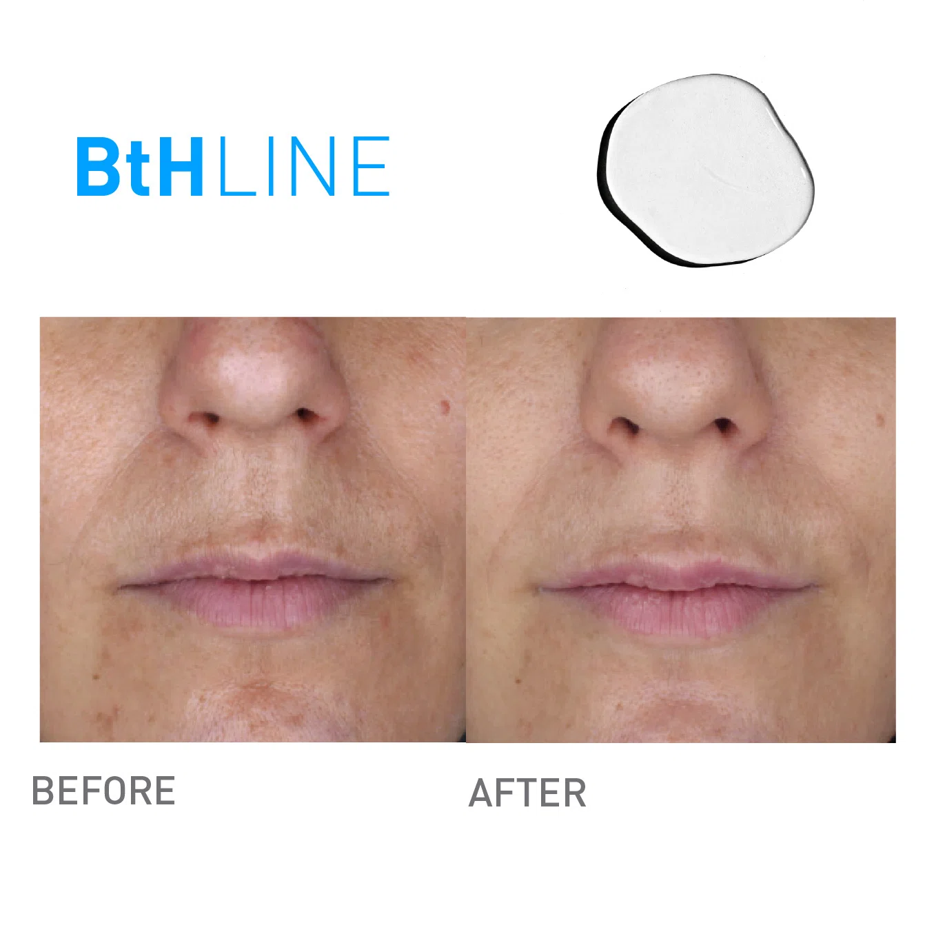 Bthline 1 4 before after results product image