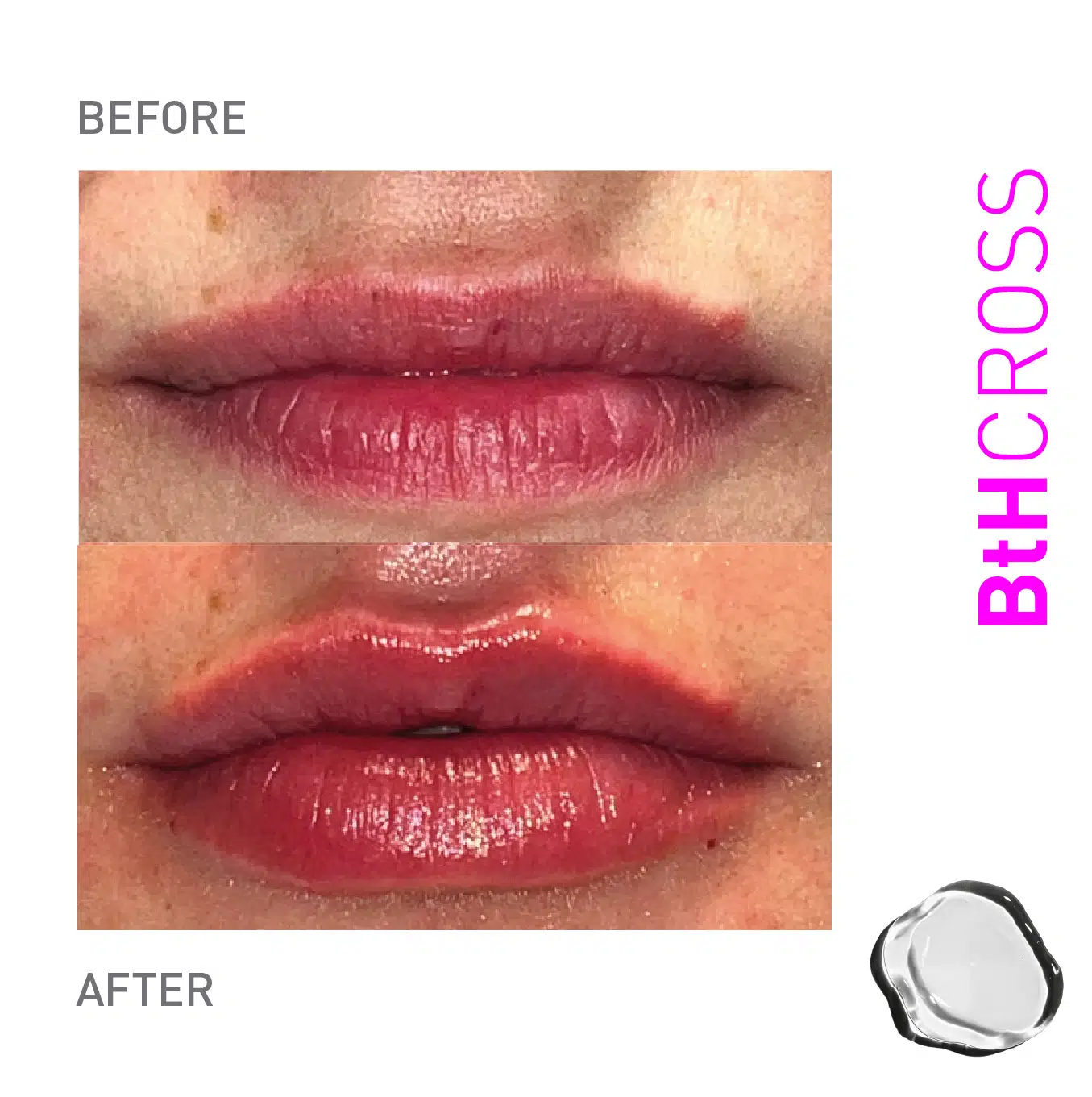 Bthcross 1 5 before after results product image