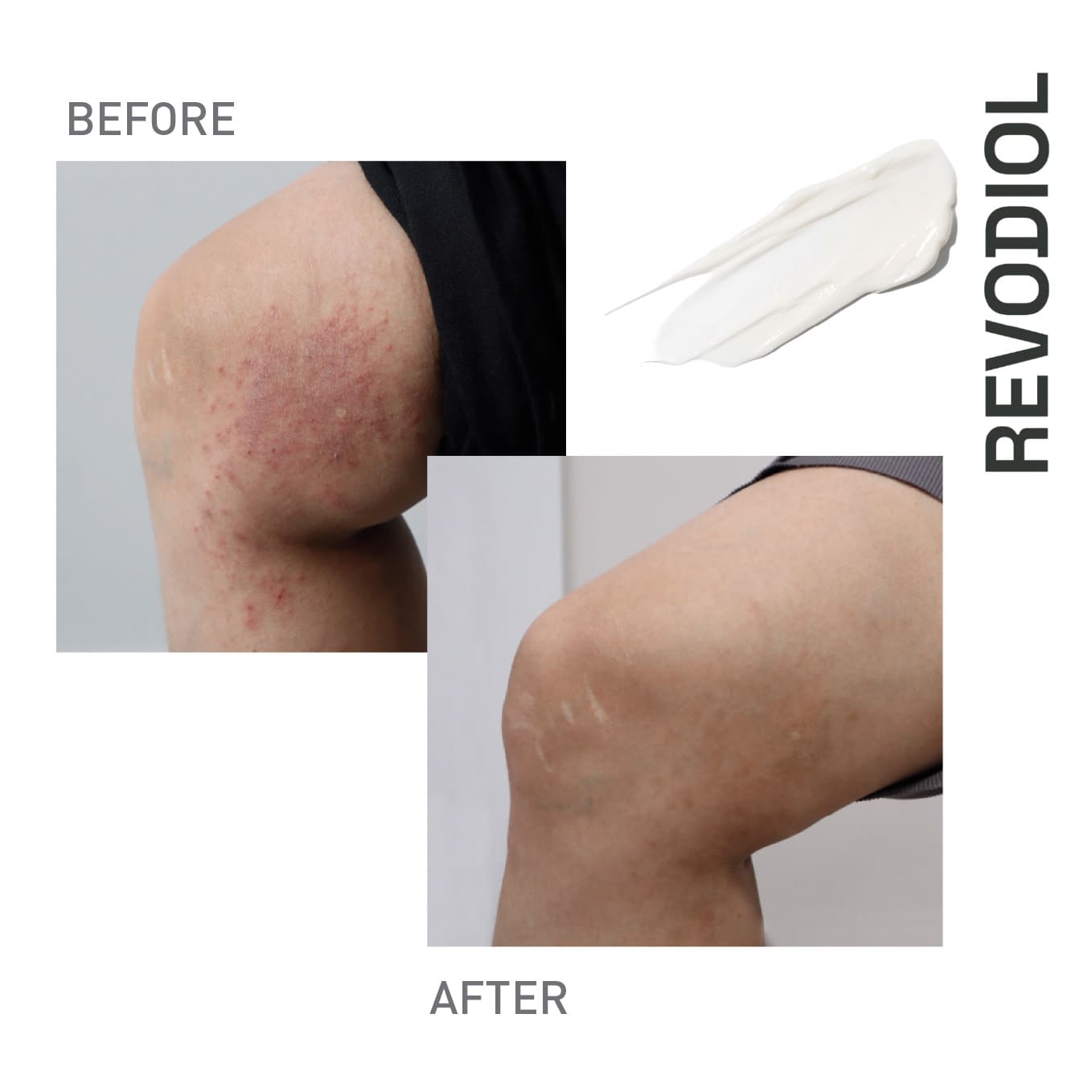Imagen de REVODIOL CREMA ANTESDESPUES EN150x 80